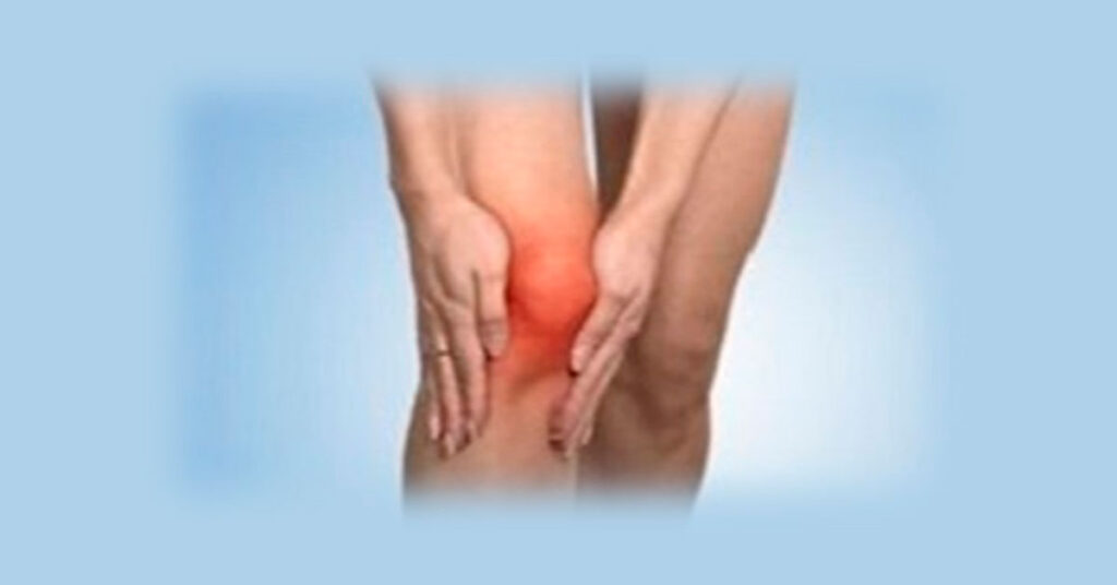 Artritis reactiva: diagnóstico y tratamiento en San Pedro Sula