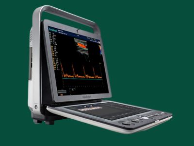 Servicio de ultrasonido con Doppler en San Pedro Sula – SonoScape S9