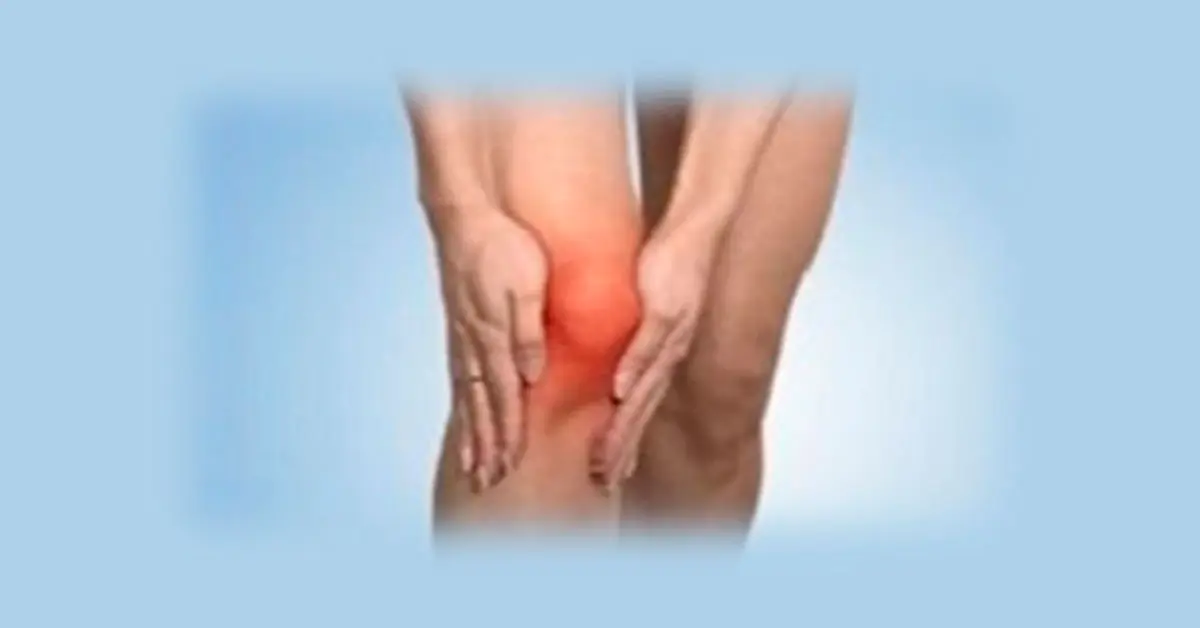 Síntomas de artritis reactiva en San Pedro Sula